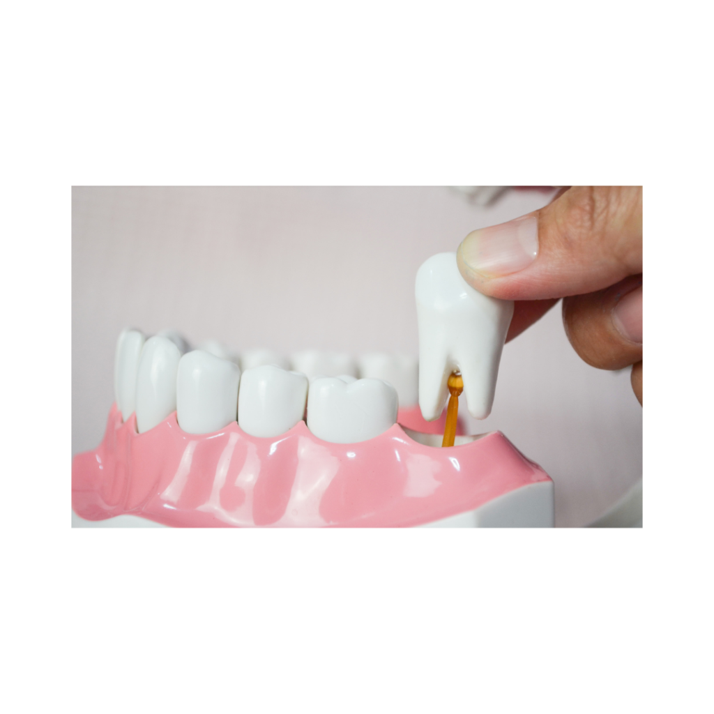 PRP/PRF Burns Dentistry