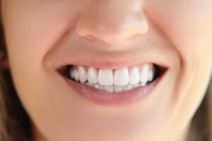 Close-up Of Female Showing Healthy Smooth White Teeth. Concept