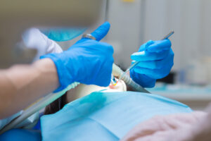 Picture of a dental patient undergoing nitrous oxide dental sedation during a procedure.