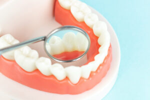 Picture of a dental mirror and a model of teeth and gums.