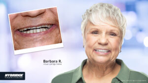 Before-and-after Hybridge implants in Sun City West, AZ