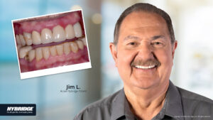 Dental implant patient in Sun City, AZ